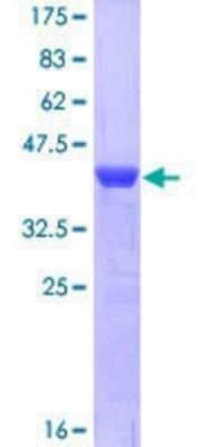 Novus Biologicals Recombinant Human AHCYL1 GST (N-Term) Protein 25 &mu;g | Buy Online | Novus Biologicals&trade; | Fisher Scientific