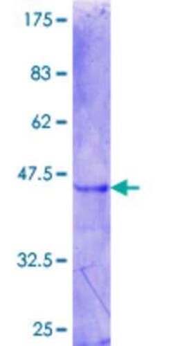 Novus Biologicals Recombinant Human ZBTB6 GST (N-Term) Protein 10 &mu;g | Buy Online | Novus Biologicals&trade; | Fisher Scientific