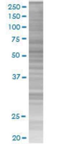 Novus Biologicals&trade;&nbsp;ZBTB6 293T Cell Transient Overexpression Lysate