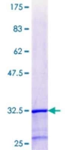 Novus Biologicals Recombinant Human ZNF266 GST (N-Term) Protein 25 &mu;g | Buy Online | Novus Biologicals&trade; | Fisher Scientific