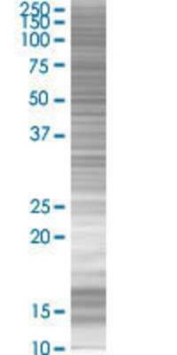 Novus Biologicals ZNF266 293T Cell Transient Overexpression Lysate 0.1 mL | Buy Online | Novus Biologicals&trade; | Fisher Scientific