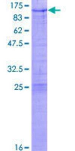 Novus Biologicals Recombinant Human ZNF274 GST (N-Term) Protein 10 &mu;g | Buy Online | Novus Biologicals&trade; | Fisher Scientific