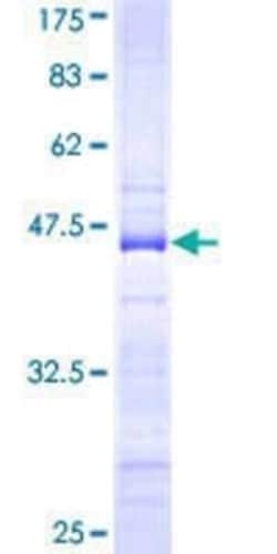 Novus Biologicals Recombinant Human ZNF274 GST (N-Term) Protein 10 &mu;g | Buy Online | Novus Biologicals&trade; | Fisher Scientific