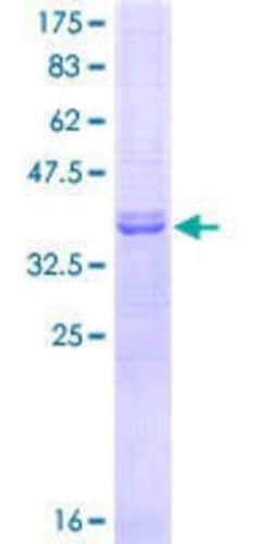 Novus Biologicals Recombinant Human NEK6 GST (N-Term) Protein 10 &mu;g | Buy Online | Novus Biologicals&trade; | Fisher Scientific