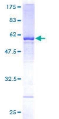 Novus Biologicals Recombinant Human WDR4 GST (N-Term) Protein 2 &mu;g | Buy Online | Novus Biologicals&trade; | Fisher Scientific