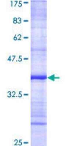 Novus Biologicals Recombinant Human NCKAP1 GST (N-Term) Protein 10 &mu;g | Buy Online | Novus Biologicals&trade; | Fisher Scientific
