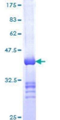 Novus Biologicals Recombinant Human IQGAP2 GST (N-Term) Protein 25 &mu;g | Buy Online | Novus Biologicals&trade; | Fisher Scientific