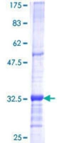 Novus Biologicals Recombinant Human RPP40 GST (N-Term) Protein 25 &mu;g | Buy Online | Novus Biologicals&trade; | Fisher Scientific