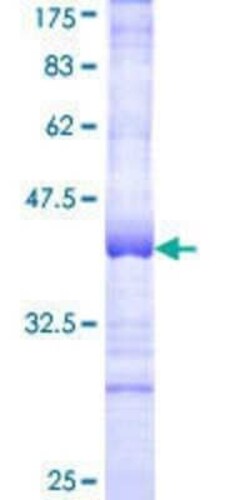 Novus Biologicals Recombinant Human Cysteinyl Leukotriene R1/CysLTR1 GST (N-Term) Protein 25 &mu;g | Buy Online | Novus Biologicals&trade; | Fisher Scientific