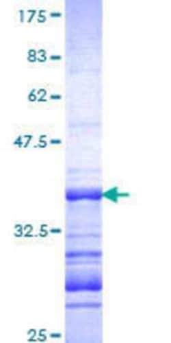 Novus Biologicals Recombinant Human Septin-9 GST (N-Term) Protein 10 &mu;g | Buy Online | Novus Biologicals&trade; | Fisher Scientific