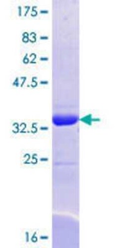 Novus Biologicals Recombinant Human SEC24A GST (N-Term) Protein 10 &mu;g | Buy Online | Novus Biologicals&trade; | Fisher Scientific