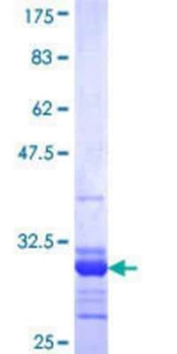 Novus Biologicals Recombinant Human Connexin 30/GJB6 GST (N-Term) Protein 25 &mu;g | Buy Online | Novus Biologicals&trade; | Fisher Scientific