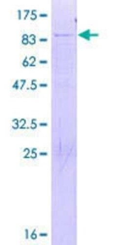 Novus Biologicals Recombinant Human FRS3 GST (N-Term) Protein 2 &mu;g | Buy Online | Novus Biologicals&trade; | Fisher Scientific