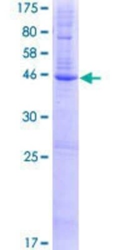 Novus Biologicals Recombinant Human C5orf4 GST (N-Term) Protein 25 &mu;g | Buy Online | Novus Biologicals&trade; | Fisher Scientific