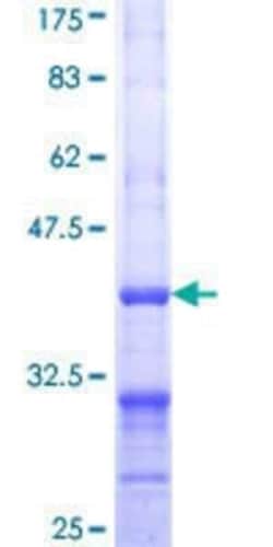 Novus Biologicals Recombinant Human ALDH1L1 GST (N-Term) Protein 25 &mu;g | Buy Online | Novus Biologicals&trade; | Fisher Scientific