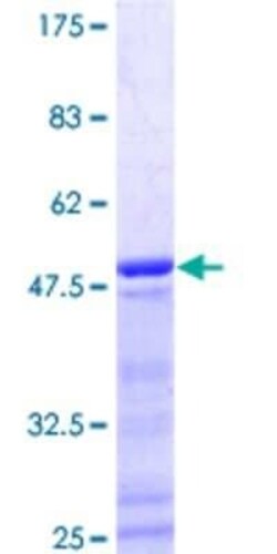 Novus Biologicals Recombinant Human G-substrate GST (N-Term) Protein 2 &mu;g | Buy Online | Novus Biologicals&trade; | Fisher Scientific