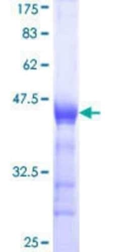 Novus Biologicals Recombinant Human G-substrate GST (N-Term) Protein 25 &mu;g | Buy Online | Novus Biologicals&trade; | Fisher Scientific