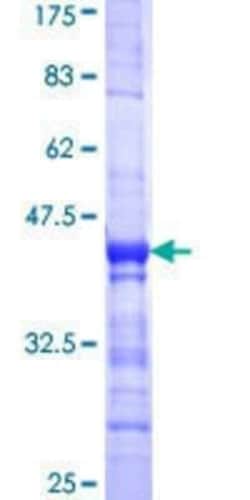 Novus Biologicals Recombinant Human PAF49 GST (N-Term) Protein 10 &mu;g | Buy Online | Novus Biologicals&trade; | Fisher Scientific