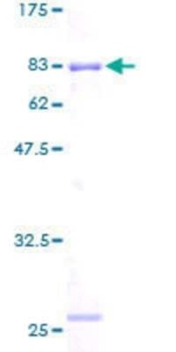 Novus Biologicals Recombinant Human RUVBL2 GST (N-Term) Protein 25 &mu;g | Buy Online | Novus Biologicals&trade; | Fisher Scientific