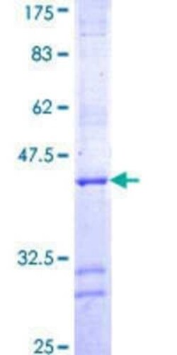 Novus Biologicals Recombinant Human RUVBL2 GST (N-Term) Protein 25 &mu;g | Buy Online | Novus Biologicals&trade; | Fisher Scientific