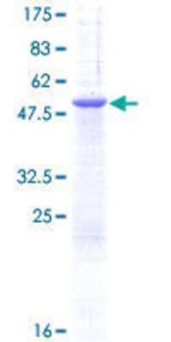 Novus Biologicals Recombinant Human PGRMC1 GST (N-Term) Protein 25 &mu;g | Buy Online | Novus Biologicals&trade; | Fisher Scientific