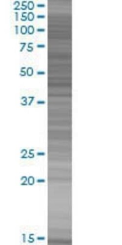 Novus Biologicals ARID5A 293T Cell Transient Overexpression Lysate 0.1 mL | Buy Online | Novus Biologicals&trade; | Fisher Scientific