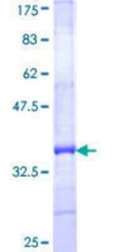 Novus Biologicals™ Recombinant Human HCP5 GST (N-Term) Protein