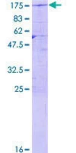 Novus Biologicals Recombinant Human USP20 GST (N-Term) Protein 25 &mu;g | Buy Online | Novus Biologicals&trade; | Fisher Scientific