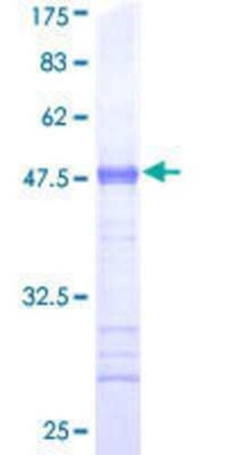 Novus Biologicals Recombinant Human USP20 GST (N-Term) Protein 25 &mu;g | Buy Online | Novus Biologicals&trade; | Fisher Scientific