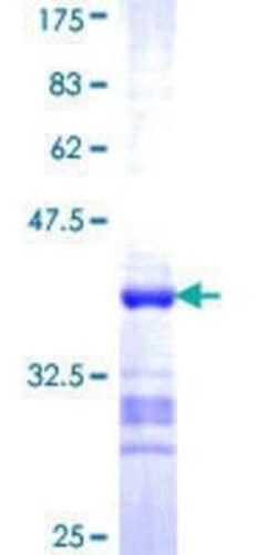 Novus Biologicals Recombinant Human ACTL7B GST (N-Term) Protein 10 &mu;g | Buy Online | Novus Biologicals&trade; | Fisher Scientific