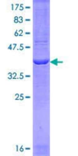Novus Biologicals Recombinant Human PGC1 alpha GST (N-Term) Protein 10 &mu;g | Buy Online | Novus Biologicals&trade; | Fisher Scientific