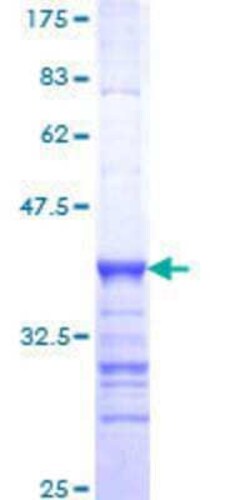 Novus Biologicals Recombinant Human BRD8 GST (N-Term) Protein 10 &mu;g | Buy Online | Novus Biologicals&trade; | Fisher Scientific