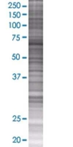 Novus Biologicals MAN1A2 293T Cell Transient Overexpression Lysate 0.1 mL | Buy Online | Novus Biologicals&trade; | Fisher Scientific