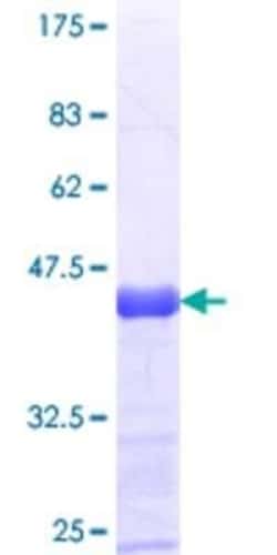 Novus Biologicals Recombinant Human PNPLA6 GST (N-Term) Protein 25 &mu;g | Buy Online | Novus Biologicals&trade; | Fisher Scientific