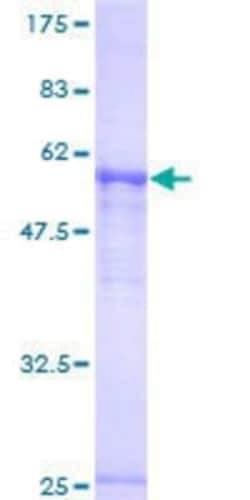 Novus Biologicals Recombinant Human PAPOLA GST (N-Term) Protein 10 &mu;g | Buy Online | Novus Biologicals&trade; | Fisher Scientific