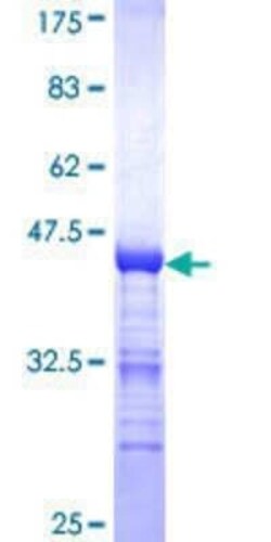 Novus Biologicals Recombinant Human MAGED2 GST (N-Term) Protein 10 &mu;g | Buy Online | Novus Biologicals&trade; | Fisher Scientific