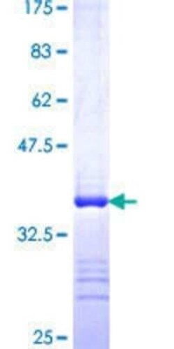 Novus Biologicals Recombinant Human RNPS1 GST (N-Term) Protein 10 &mu;g | Buy Online | Novus Biologicals&trade; | Fisher Scientific