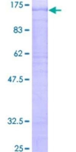 Novus Biologicals Recombinant Human DBF4 GST (N-Term) Protein 2 &mu;g | Buy Online | Novus Biologicals&trade; | Fisher Scientific