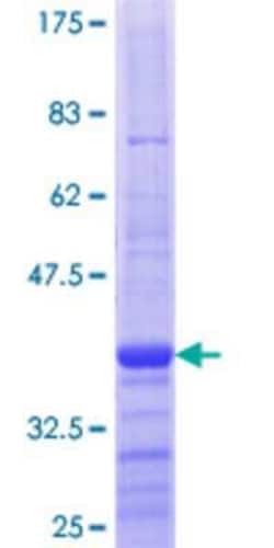 Novus Biologicals Recombinant Human DBF4 GST (N-Term) Protein 10 &mu;g | Buy Online | Novus Biologicals&trade; | Fisher Scientific