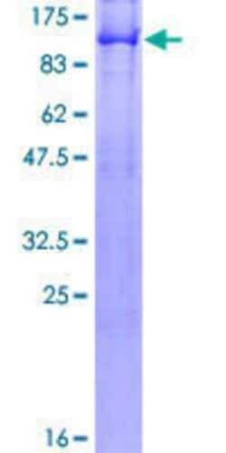 Novus Biologicals Recombinant Human RALBP1 GST (N-Term) Protein 2 &mu;g | Buy Online | Novus Biologicals&trade; | Fisher Scientific