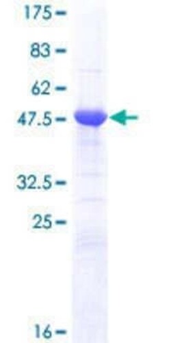 Novus Biologicals Recombinant Human APOBEC2 GST (N-Term) Protein 25 &mu;g | Buy Online | Novus Biologicals&trade; | Fisher Scientific