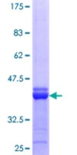 Novus Biologicals Recombinant Human APOBEC2 GST (N-Term) Protein 25 &mu;g | Buy Online | Novus Biologicals&trade; | Fisher Scientific