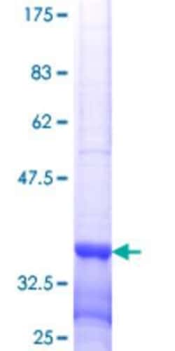 Novus Biologicals Recombinant Human MSL3L1 GST (N-Term) Protein 10 &mu;g | Buy Online | Novus Biologicals&trade; | Fisher Scientific