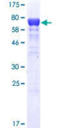 Novus Biologicals Recombinant Human SF3A3 GST (N-Term) Protein 25 &mu;g | Buy Online | Novus Biologicals&trade; | Fisher Scientific