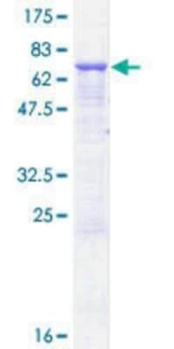 Novus Biologicals Recombinant Human AP3M2 GST (N-Term) Protein 10 &mu;g | Buy Online | Novus Biologicals&trade; | Fisher Scientific