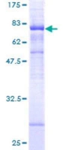 Novus Biologicals Recombinant Human STARD3 GST (N-Term) Protein 10 &mu;g | Buy Online | Novus Biologicals&trade; | Fisher Scientific