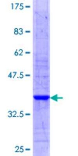 Novus Biologicals Recombinant Human STARD3 GST (N-Term) Protein 25 &mu;g | Buy Online | Novus Biologicals&trade; | Fisher Scientific