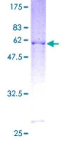 Novus Biologicals Recombinant Human BTG3 GST (N-Term) Protein 2 &mu;g | Buy Online | Novus Biologicals&trade; | Fisher Scientific