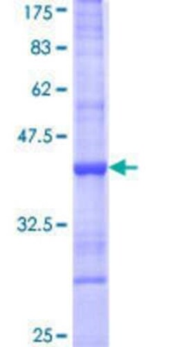 Novus Biologicals Recombinant Human PDIR GST (N-Term) Protein 25 &mu;g | Buy Online | Novus Biologicals&trade; | Fisher Scientific