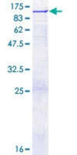 Novus Biologicals Recombinant Human OS9 GST (N-Term) Protein 2 &mu;g | Buy Online | Novus Biologicals&trade; | Fisher Scientific